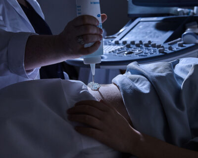 A cosa serve il gel per ultrasuoni e come scegliere quello giusto